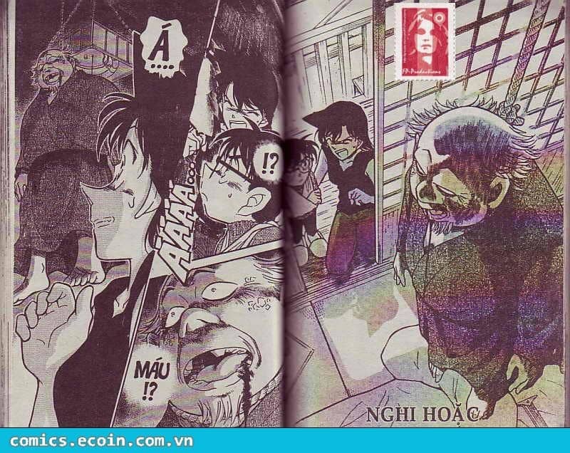 Thám Tử Conan - Chương 408 - ảnh 2
