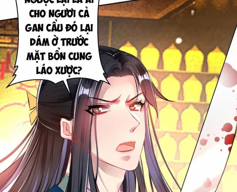 Vương Gia, Áo Lót Của Ngươi Rơi Mất Rồi - Chương 58 - ảnh 44